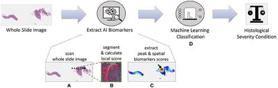 Harnessing artificial intelligence to infer novel spatial biomarkers for the diagnosis of eosinophilic esophagitis